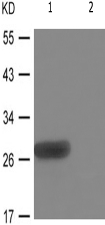 兔抗CDKN1B(Phospho-Thr198)多克隆抗体