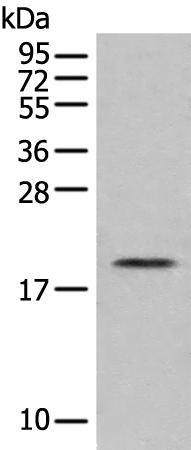 兔抗EFNA2多克隆抗体