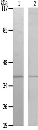 兔抗EFNA3多克隆抗体