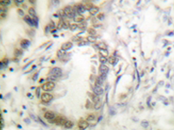兔抗CEBPA(Phospho-Ser21)多克隆抗体