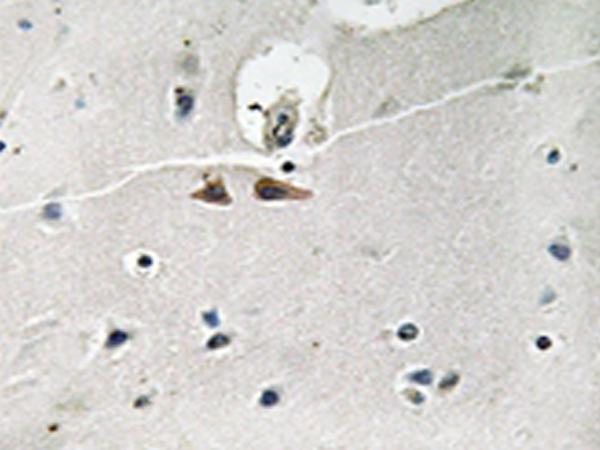 兔抗EFNB1/2/3(Phospho-Tyr324)多克隆抗体