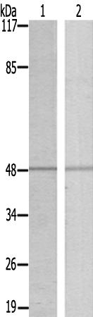 兔抗EGR1/2多克隆抗体