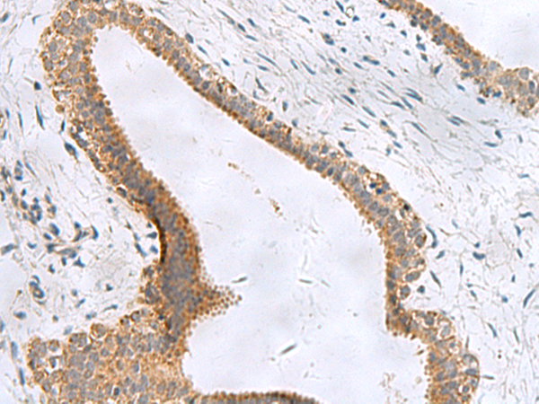 兔抗CEMIP多克隆抗体