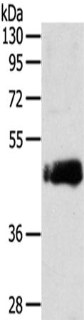 兔抗ENTR1多克隆抗体