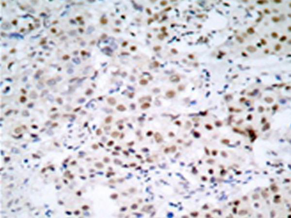 兔抗CREB1(Ab-129/133)多克隆抗体