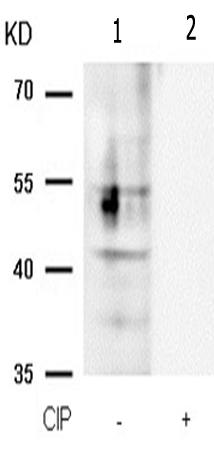 兔抗CREB1(Phospho-Ser142)多克隆抗体