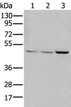 兔抗EFNB3多克隆抗体