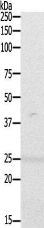 兔抗Fadd(Phospho-Ser191)多克隆抗体