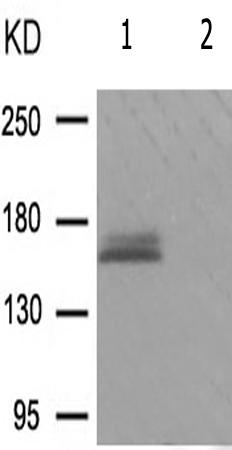 兔抗FANCD2(Phospho-Ser222)多克隆抗体