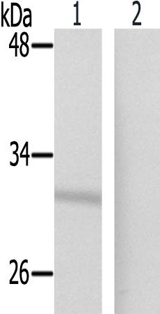 兔抗FCGR2B(Phospho-Tyr292)多克隆抗体