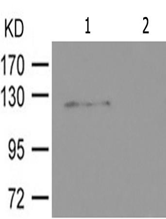 兔抗FGFR1(Phospho-Tyr654)多克隆抗体