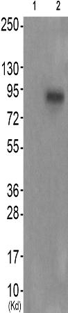 兔抗FGFR4(Phospho-Tyr642)多克隆抗体 
