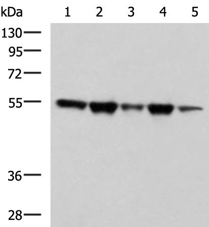 兔抗FKBP5多克隆抗体  