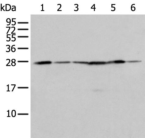 兔抗FKBP7多克隆抗体