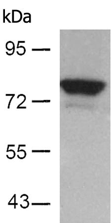 兔抗FOXO1(Ab-256)多克隆抗体