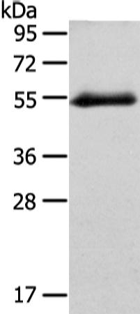 兔抗GLRA1多克隆抗体 