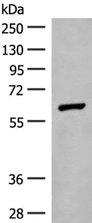 兔抗GLS2多克隆抗体