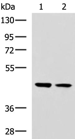 兔抗GLT8D1多克隆抗体