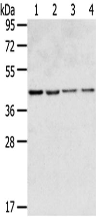 兔抗GPR15多克隆抗体