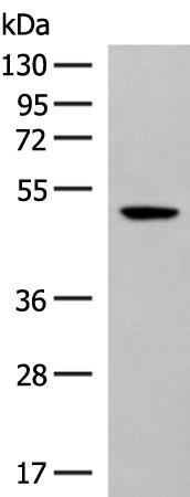 兔抗GPR142多克隆抗体
