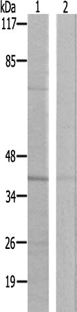 兔抗GPR68多克隆抗体