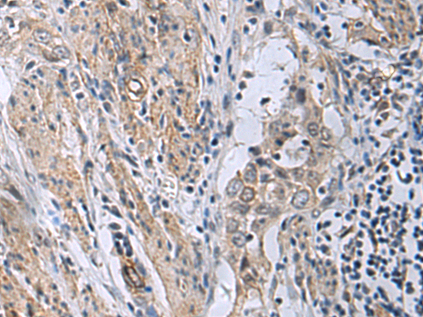 兔抗MBL2多克隆抗体