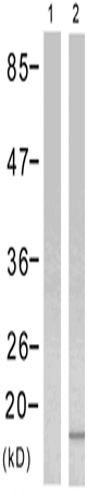 兔抗HIST1H3D (Phospho-Ser10)多克隆抗体