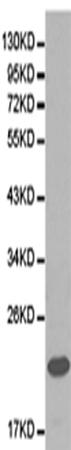 兔抗FXN多克隆抗体