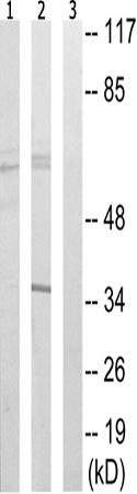 兔抗FYN(Ab-530)多克隆抗体 