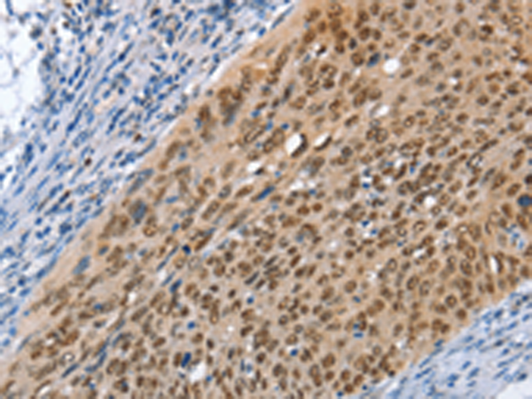 兔抗MCM6多克隆抗体