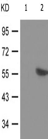兔抗FYN(Phospho-Tyr530)多克隆抗体 