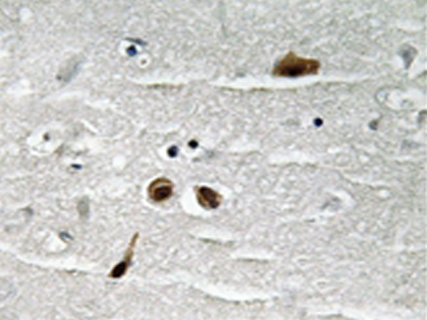 兔抗MDC1(Phospho-Ser513) 多克隆抗体