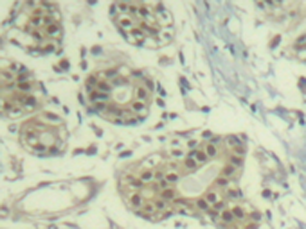 兔抗MDM2 (phospho-Ser166)多克隆抗体