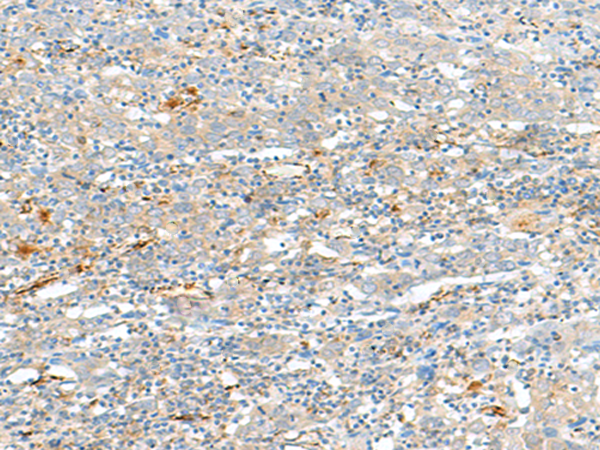 兔抗HLA-DQA2多克隆抗体 