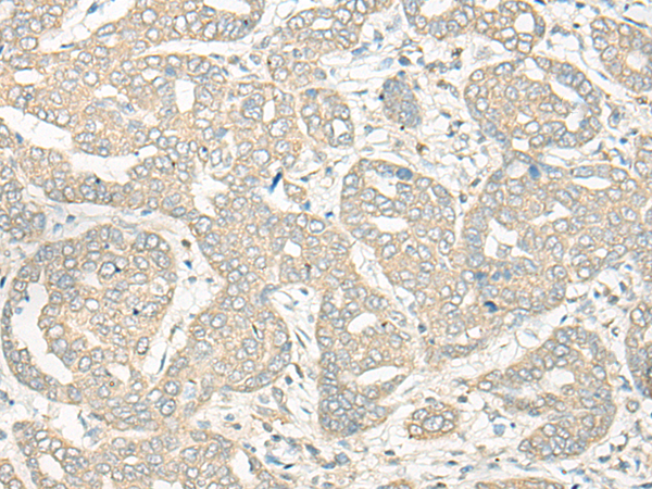 兔抗HLA-DRB5多克隆抗体 