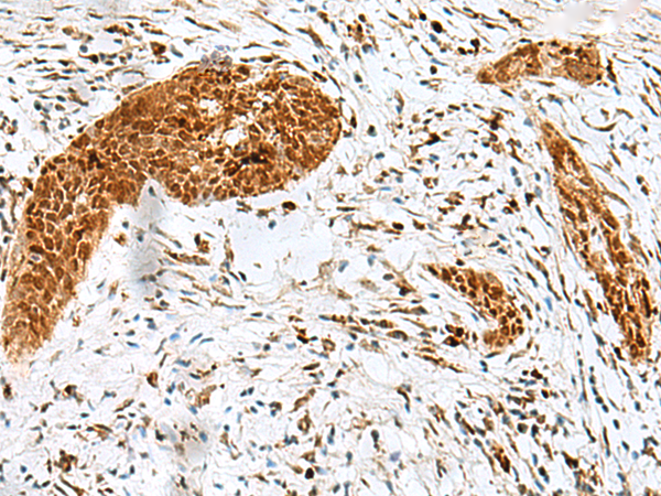   兔抗HMG20A多克隆抗体   