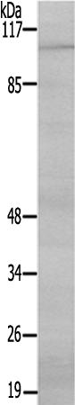兔抗GAB2(Ab-159)多克隆抗体 
