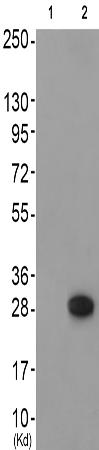 兔抗GAB2(Phospho-Tyr643) 多克隆抗体 