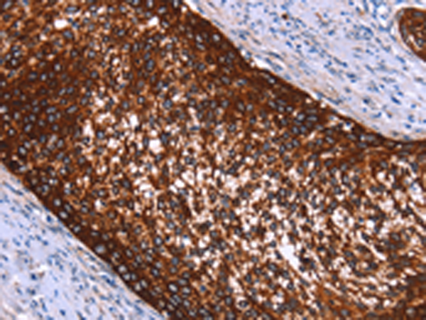 兔抗HMGCS2多克隆抗体 