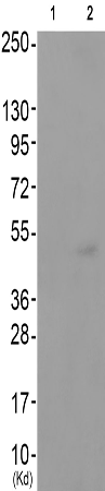 兔抗MEF2C(Phospho-Ser396)多克隆抗体