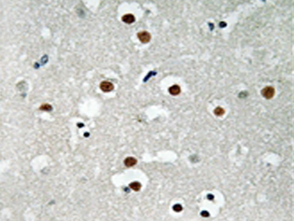 兔抗MEF2C(Phospho-Ser396)多克隆抗体