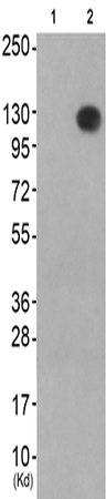 兔抗MERTKTYRO3(Ab-753685) 多克隆抗体