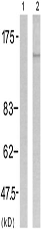 兔抗MET (Phospho-Tyr1349)多克隆抗体