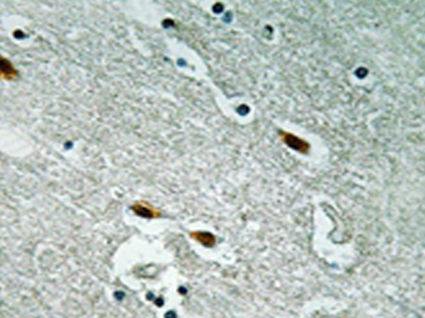 兔抗MET(Ab-1003) 多克隆抗体