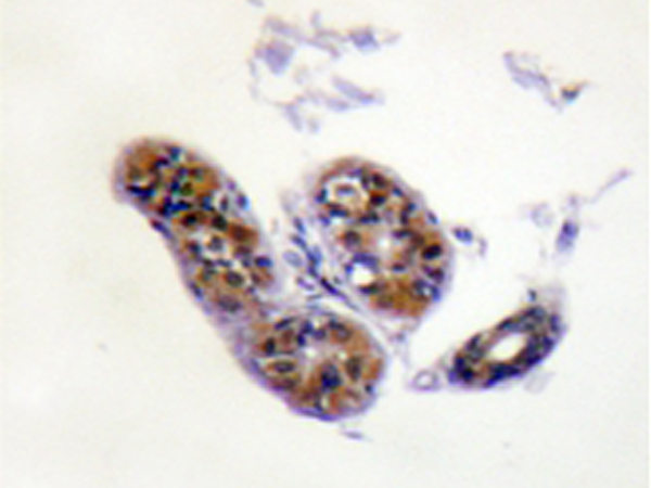 兔抗MITF(Ab-18073) 多克隆抗体
