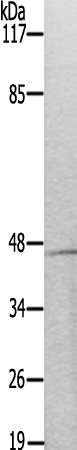 兔抗MKNK1(Ab-385) 多克隆抗体