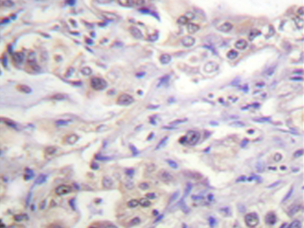 兔抗HNRNPD(Phospho-Ser83) 多克隆抗体 
