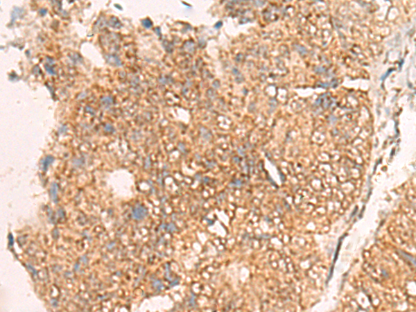 兔抗MOB1A多克隆抗体