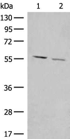 兔抗GADL1多克隆抗体