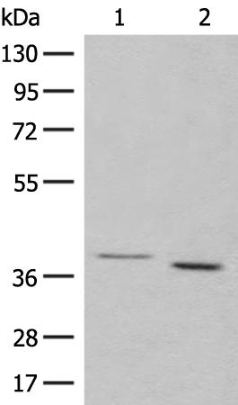 兔抗GALR1多克隆抗体
